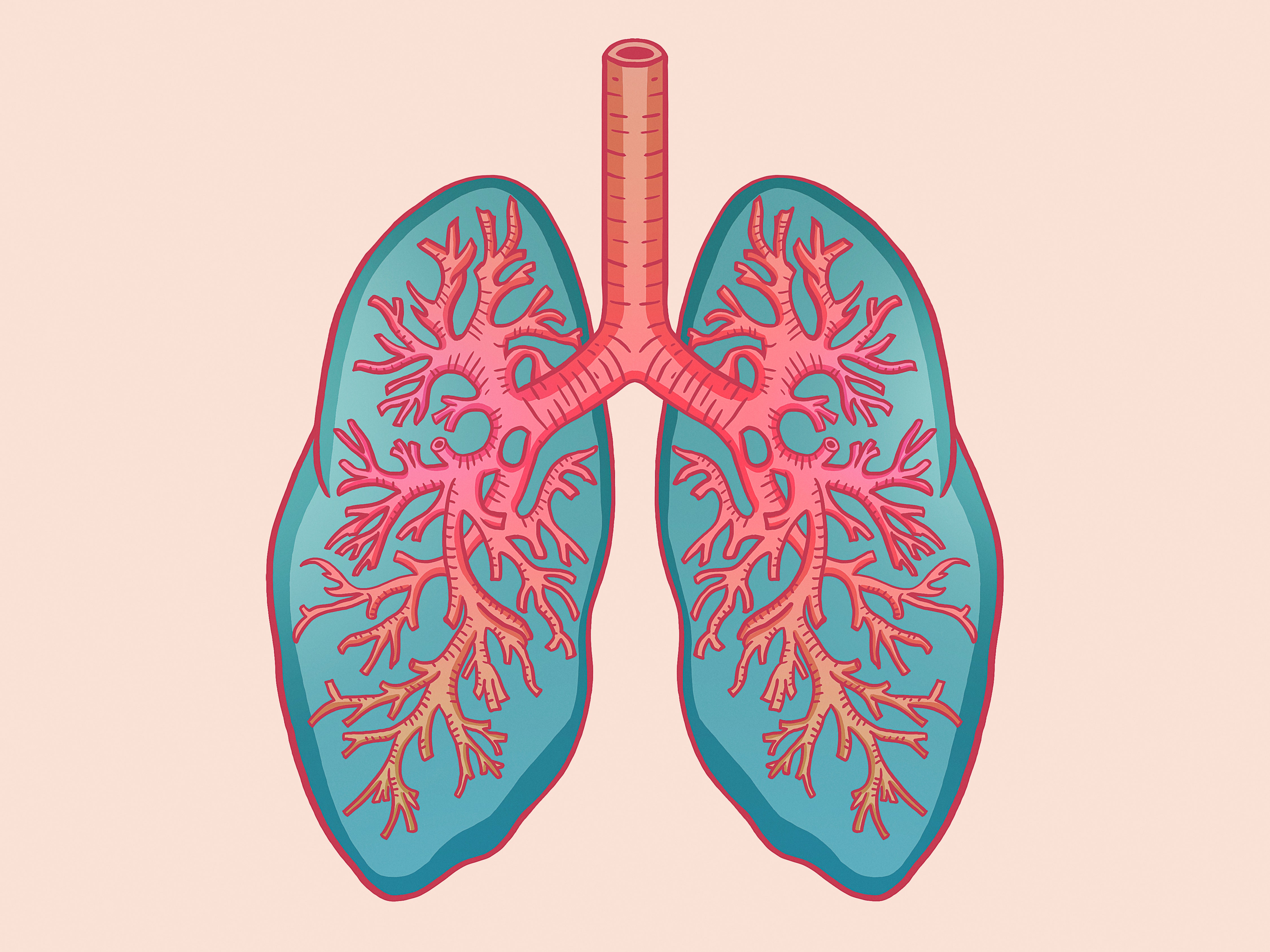 Walking Pneumonia Is on the Rise. Here Are the Symptoms to Look Out For